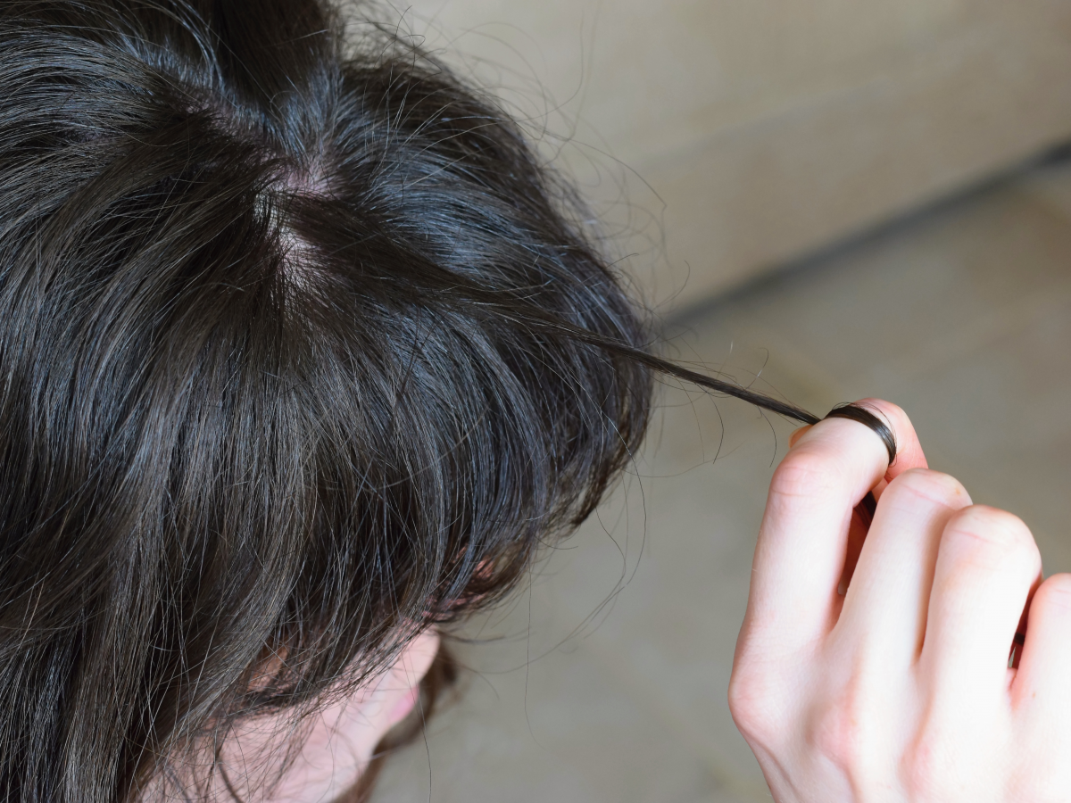 Trichotillomania - Hair Pulling Disorder